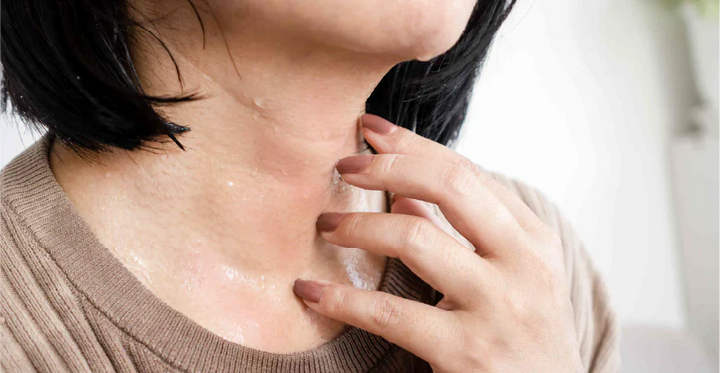 Excessive Sweating | Powerful Causes and Smart Relief