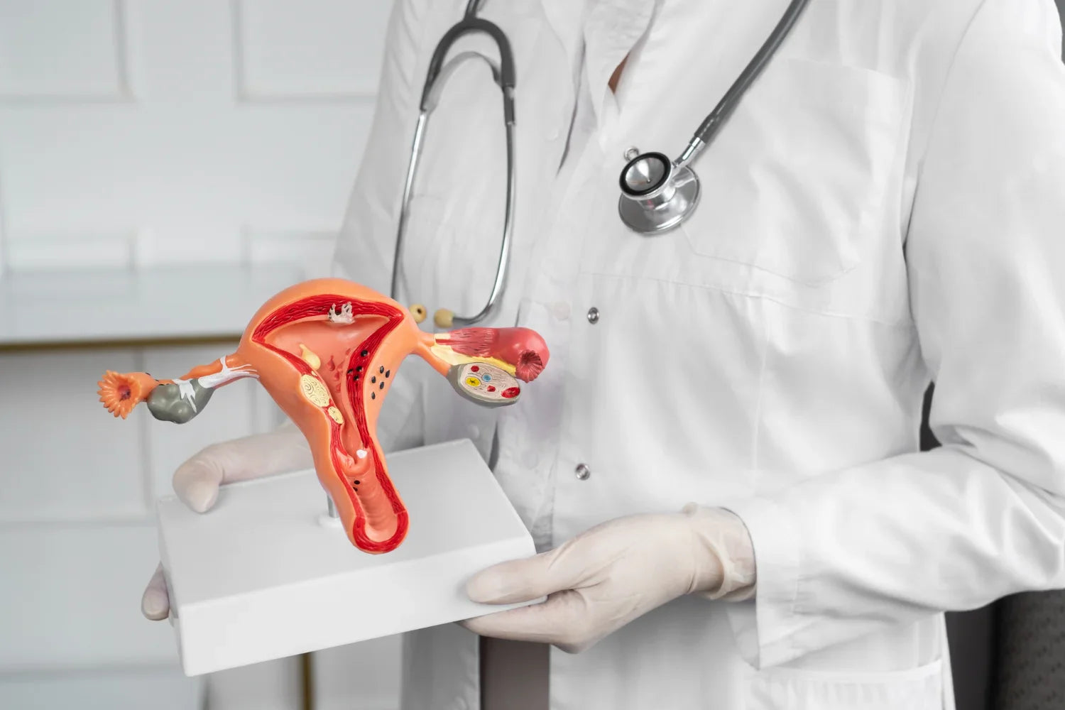 Ovarian Cysts