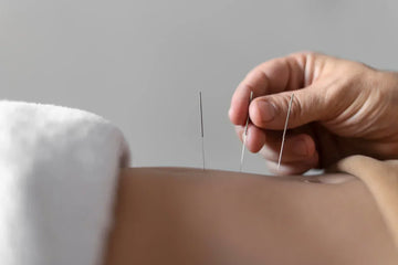 Acupuncture for Women