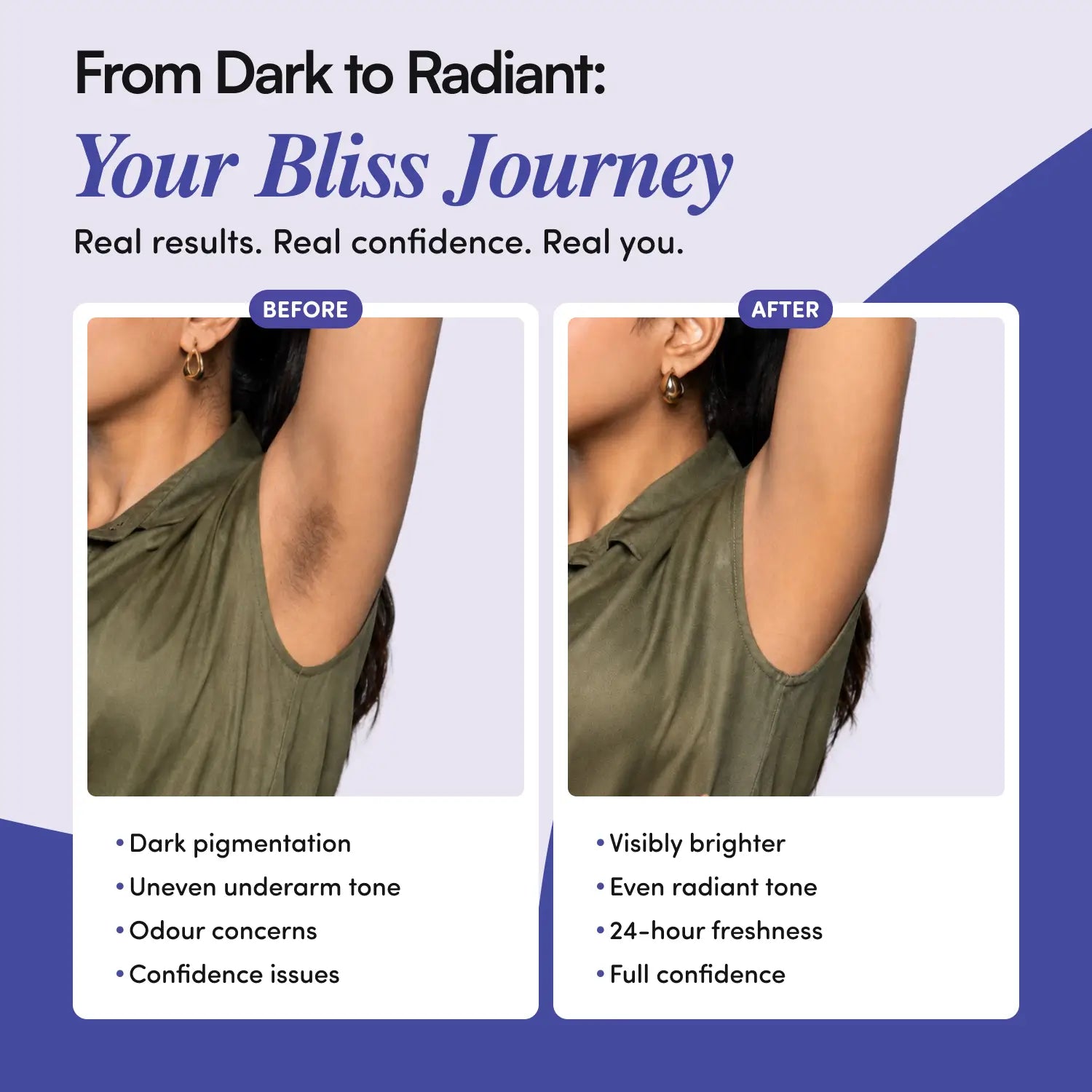 Underarm Roll-On for Women (50 ml) | Daily Care